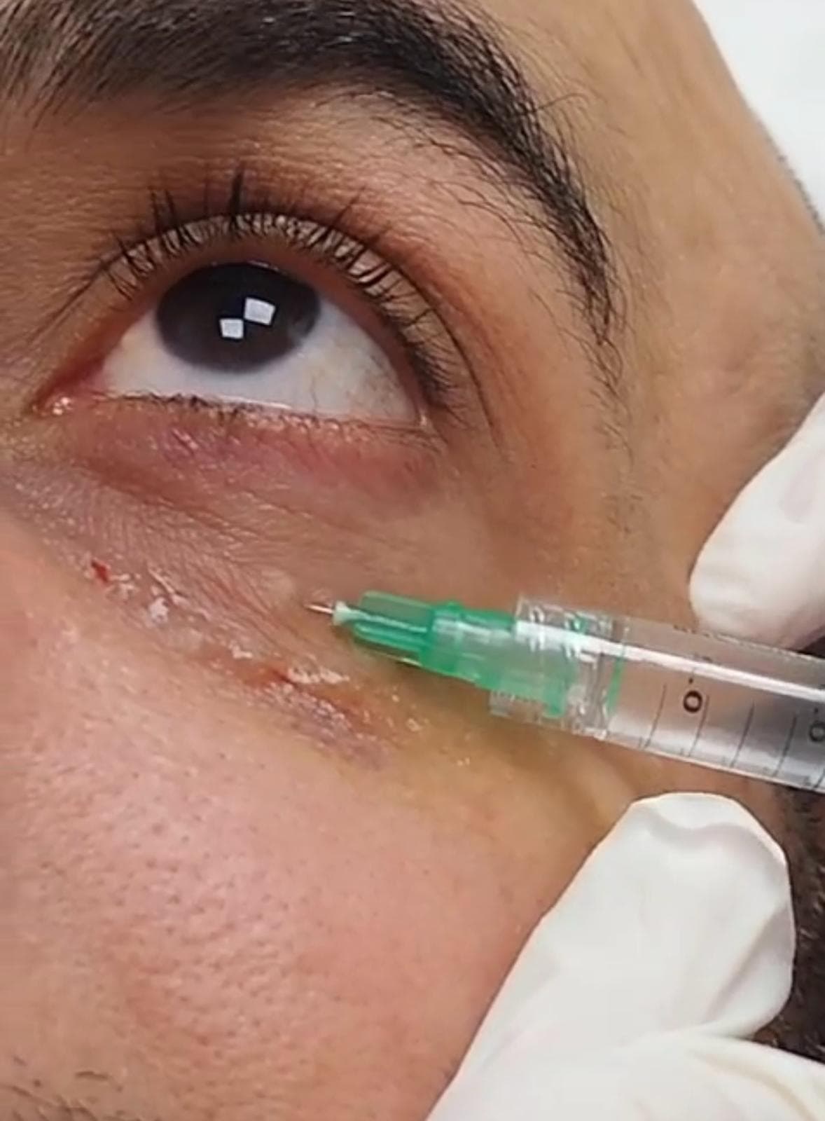 Facial profile showcasing natural skin texture and contours